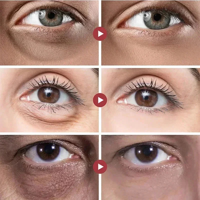Anti Dark Circle Eye Cream Fat Granules Removal Cream Anti-Wrinkle Lifting Moisturizing Firming Anti-Puffiness Korean Skin Care