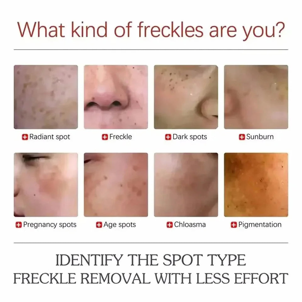 Anti Dark Circle Eye Cream Fat Granules Removal Cream Anti-Wrinkle Lifting Moisturizing Firming Anti-Puffiness Korean Skin Care