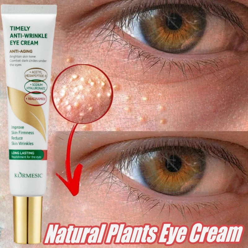 Anti Dark Circle Eye Cream Fat Granules Removal Cream Anti-Wrinkle Lifting Moisturizing Firming Anti-Puffiness Korean Skin Care