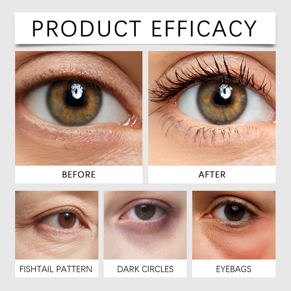 Eye Firming Cream Gentle Care For Eye Skin Gentle Ingredients For Moisturizing And Locking In Moisture Daily Care Massage Cream