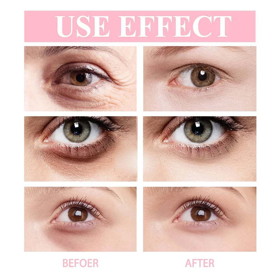 Anti-wrinkle Eye Cream Retinol Anti Puffiness Remove Dark Circles Eye Bags Stick Fade Fine Line Whitening Moisturizing Skin Care